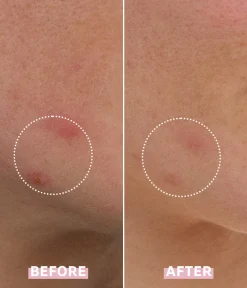 OH MY CICA SPOT GEL CREAM