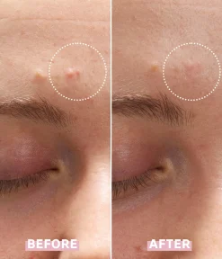 OH MY CICA SPOT GEL CREAM