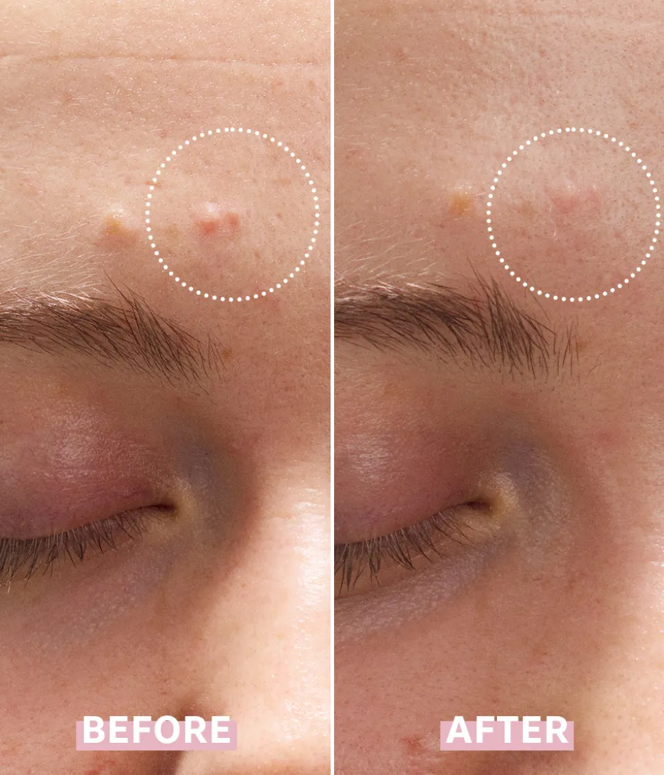 OH MY CICA SPOT GEL CREAM